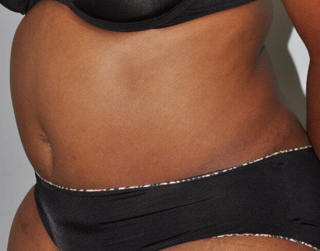 After - left_oblique