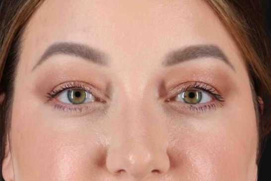 After - 1151-1159-1549