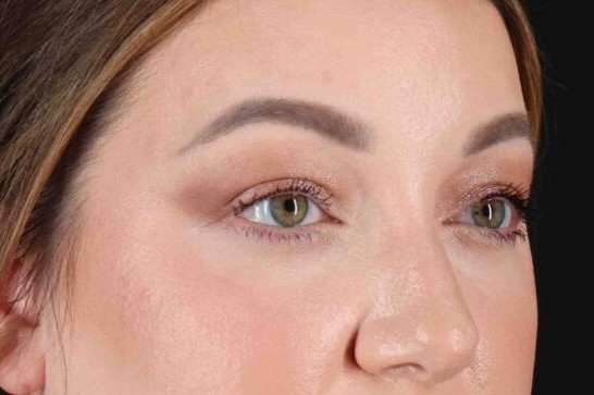 After - right_oblique