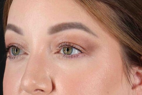 After - left_oblique