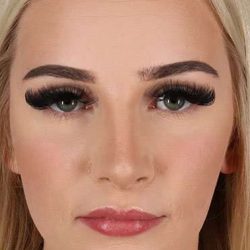 Brow Lift Before & After Patient #4876