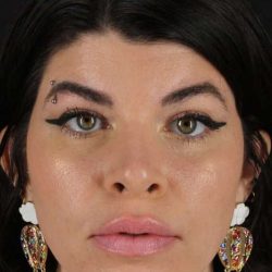 Brow Lift Before & After Patient #4912