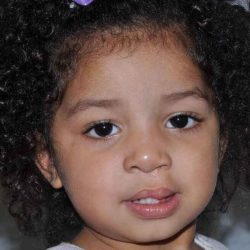 Cleft Lip Palate Before & After Patient #4979
