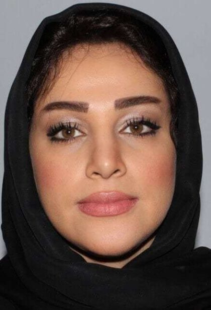 Rhinoplasty Before & After Patient #6054