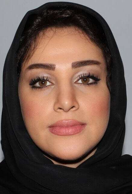 Rhinoplasty Before & After Patient #6054