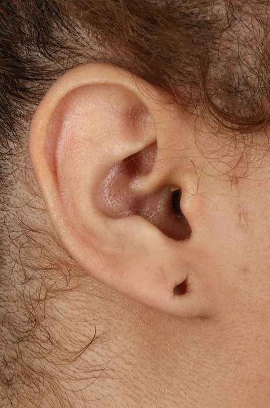 Earlobe Repair Before & After Patient #5053