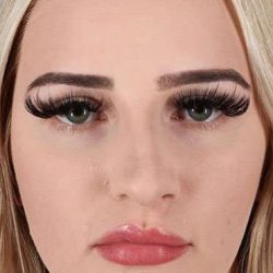 Rhinoplasty Before & After Patient #6005