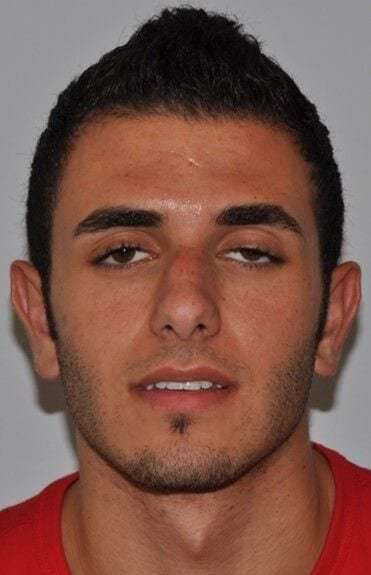 Rhinoplasty Before & After Patient #6028