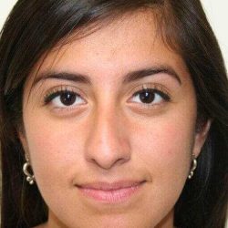 Rhinoplasty Before & After Patient #6040