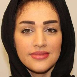 Rhinoplasty Before & After Patient #6054
