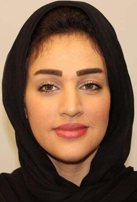 Rhinoplasty Before & After Patient #6054