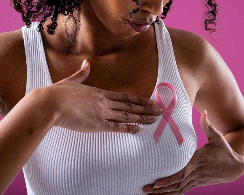 DIEP Flap Breast Reconstruction, Houston TX, My Houston Surgeons