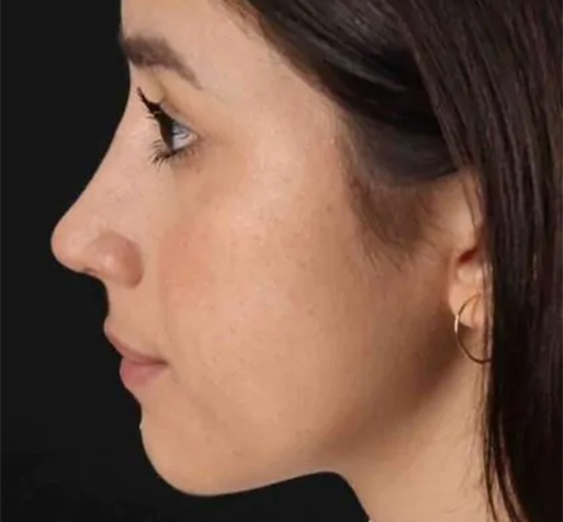 B&A