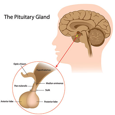 Pituitary Tumors, Houston TX, My Houston Surgeons